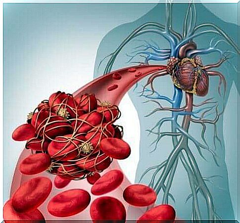 Blood clots that can cause thrombosis