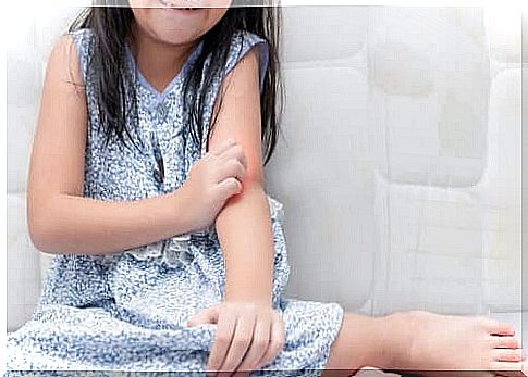 Coping With Psoriasis in Children