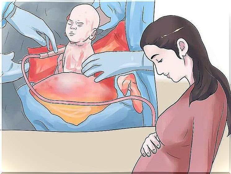 Fear of a cesarean section