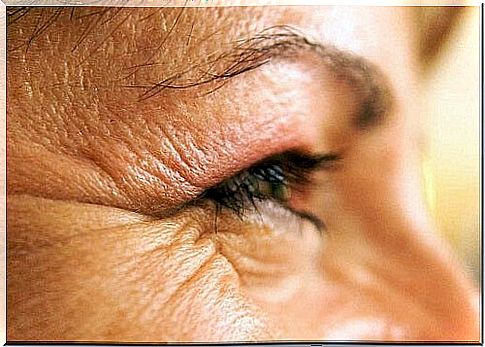 Habits That Cause Wrinkles