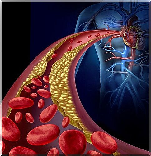 How to lower your triglyceride levels naturally