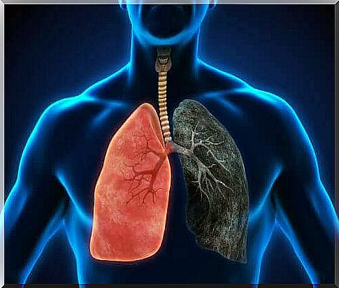 Pneumonia Symptoms You Shouldn't Ignore