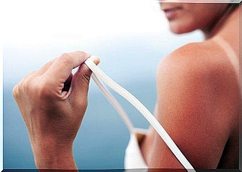 Treat sunburn with 5 natural remedies