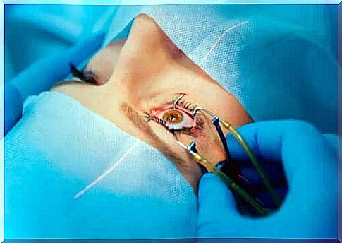 Someone undergoing scleral kinking surgery